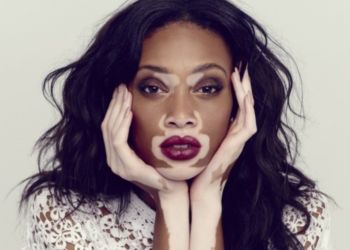 Нетипичная внешность: 15 успешных моделей, которые изменили все представления о стандартах красоты