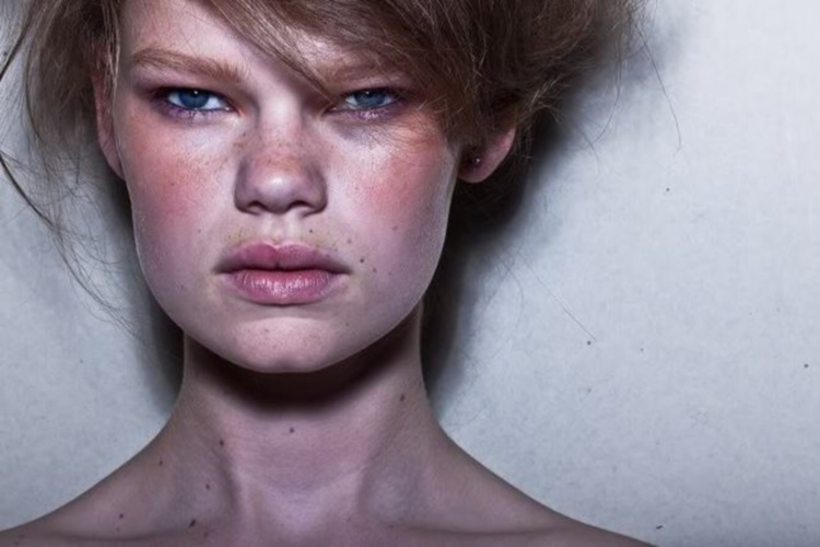 Нетипичная внешность: 15 успешных моделей, которые изменили все представления о стандартах красоты