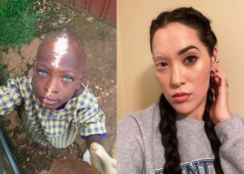 Люди, чья генетика наградила их уникальной внешностью