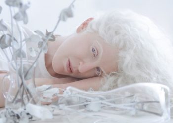 Потусторонняя красота: 30 завораживающих фото людей-альбиносов