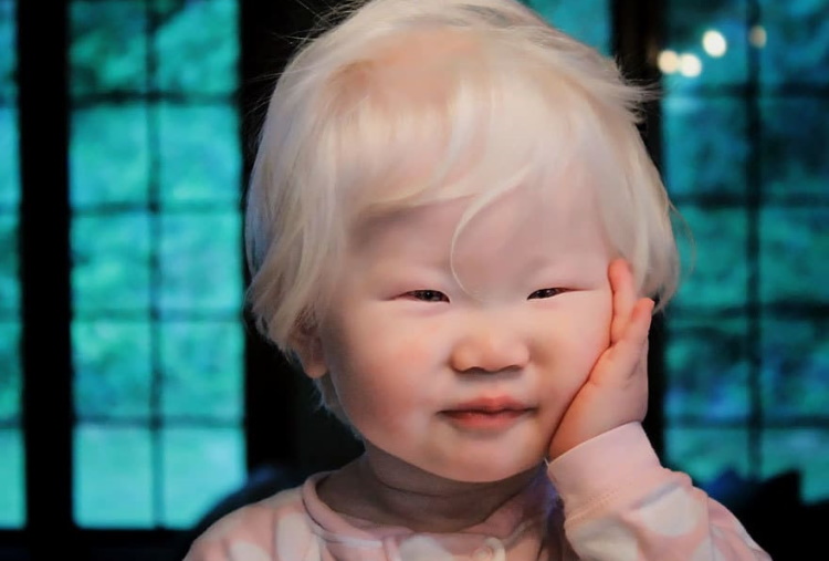 Потусторонняя красота: 30 завораживающих фото людей-альбиносов