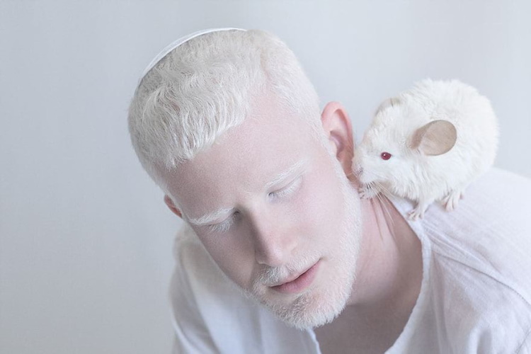 Потусторонняя красота: 30 завораживающих фото людей-альбиносов